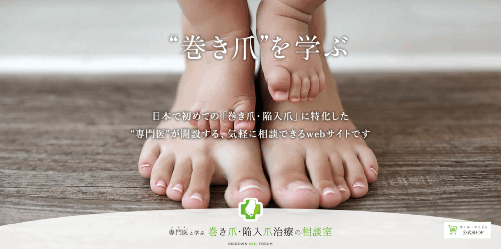 巻き爪・陥入爪治療の相談室